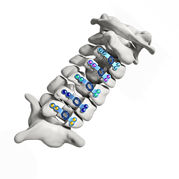 Placa de fijación de la columna vertebral